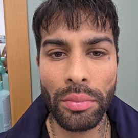 Kunal13