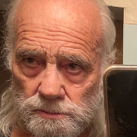 Albert3