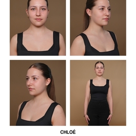 Chloekoza