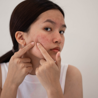 Casting homme et femme entre 18 et 25 ans pour tournage publicité skincare