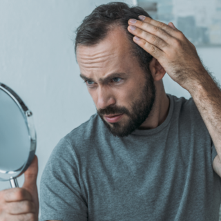 Casting homme et femme de 18 ans et plus ayant un problème d'alopécie pour video témoignage